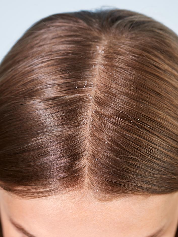 Look of hair before product use
